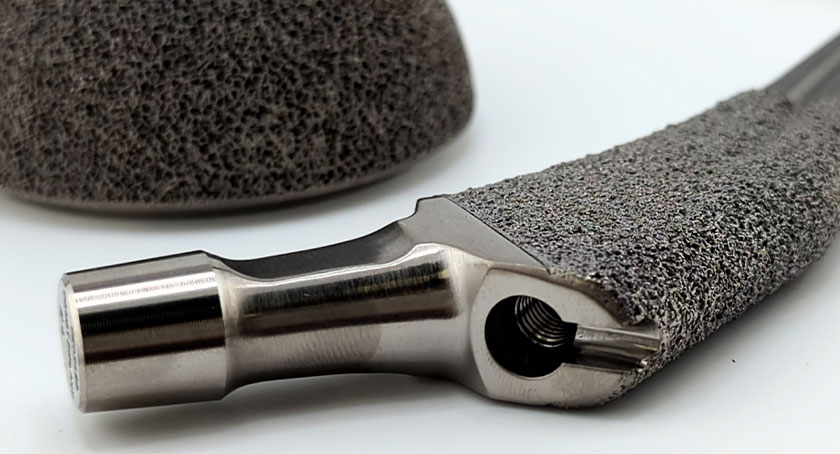 A Matter-of-Fact Discussion of Orthopedic Device Materials